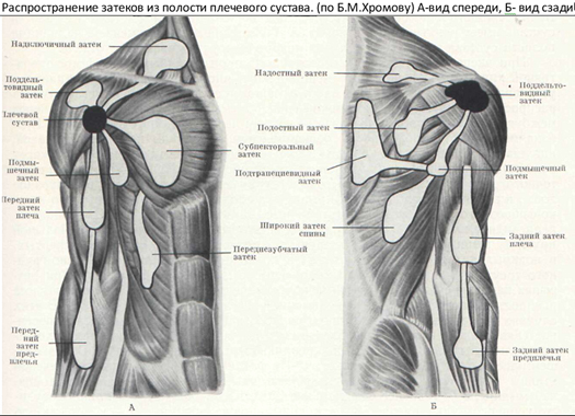 Az n5 sacroiliitis lemezének kiemelkedése spondyloarthritis - Kezelés