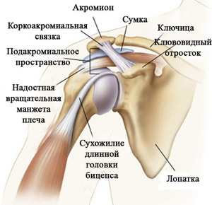 a clavicularis-acromialis ízület deformáló artrózisa)