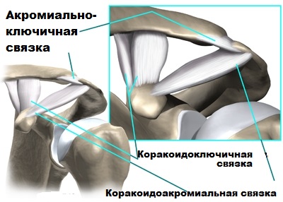Hyperparathyreosishoz csatlakozó szimmetrikus erosiv arthropathia