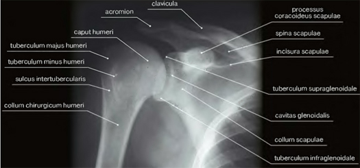 Рассмотрите рентгенограмму с изображением плечевого сустава человека как называют повреждение