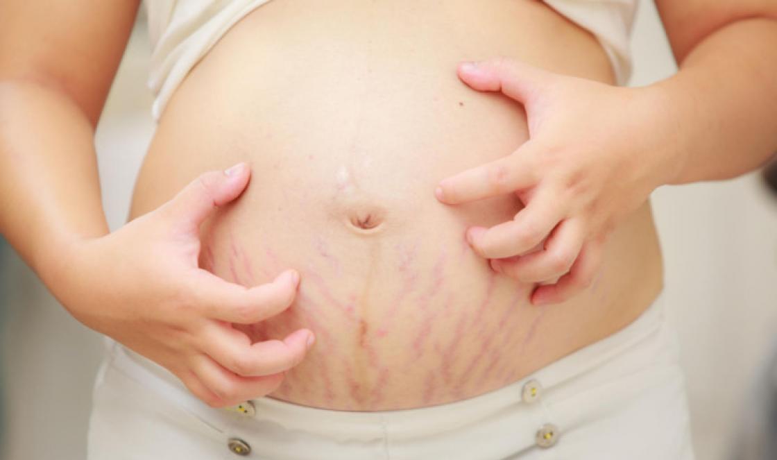 Príčiny a liečba kože so svrbením v intímnej oblasti u tehotných žien Svrbenie kože u tehotných žien ako liečba