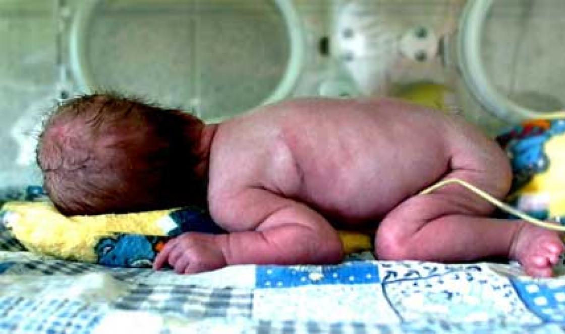 Faze dojenja prijevremeno rođenih beba i karakteristike njihove rehabilitacije Izuzetno mala težina